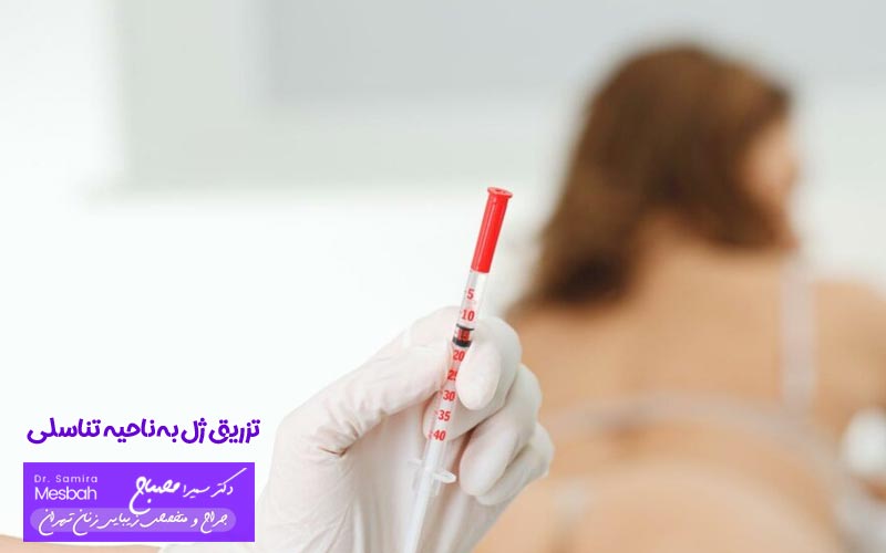 تزریق ژل به ناحیه تناسلی
