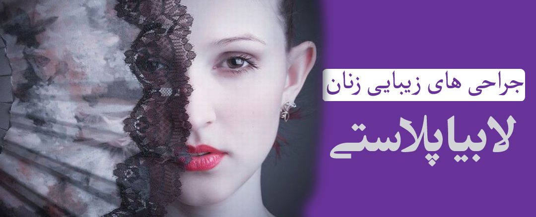 عمل لابیاپلاستی
