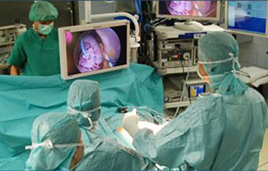 نحوه انجام هیستروسکوپی 1