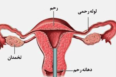 رحم و لوله های رحمی