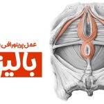 عمل پرینورافی واژن با لیزر