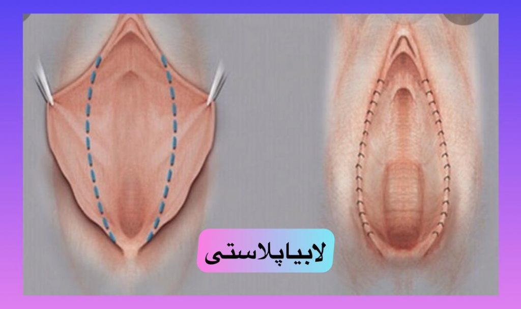 عکس عمل زیبایی زنان