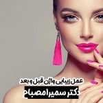 قبل و بعد از عمل زیبایی واژن