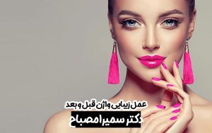 قبل و بعد از عمل زیبایی واژن