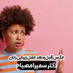 عکس قبل و بعد عمل زیبایی زنان