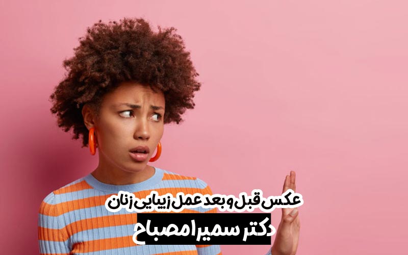 عکس قبل و بعد عمل زیبایی زنان