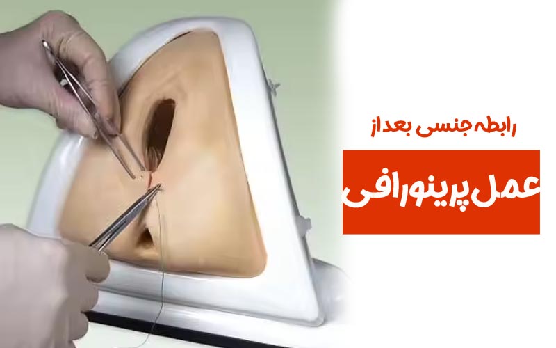 فیلم عمل جراحی واژن 6 چگونگی افزایش راحتی در رابطه بعد از عمل پرینورافی