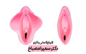 دکتر سمیرا مصباح 2 لابیاپلاستی با لیزر