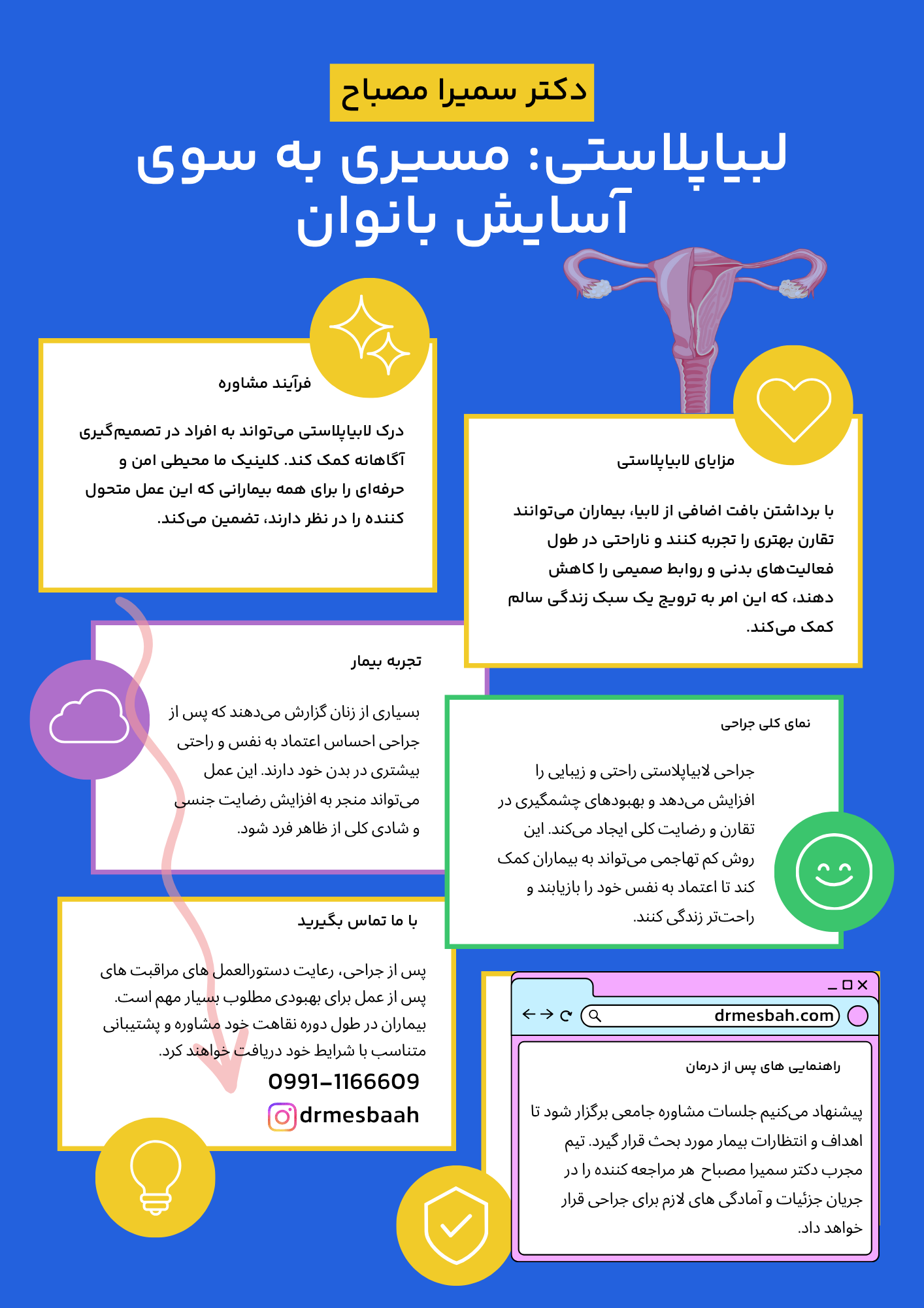 پریود بعد از عمل لابیا 3 Infographic Labiaplasty A Path To Comfort