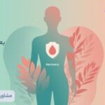 Period After Labiaplasty (1)