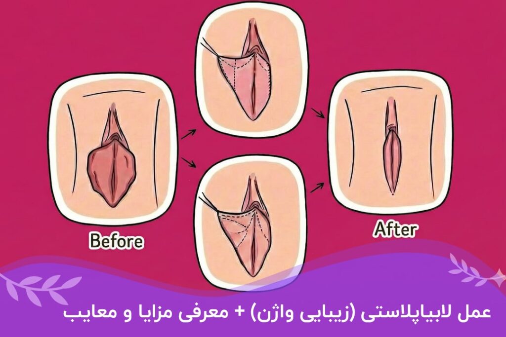 لابیاپلاستی در بیمارستان دولتی