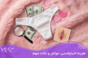 هزینه لابیاپلاستی