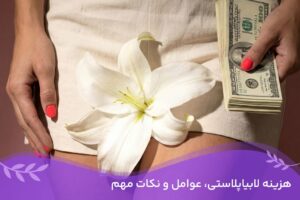دکتر سمیرا مصباح 14 هزینه لابیاپلاستی