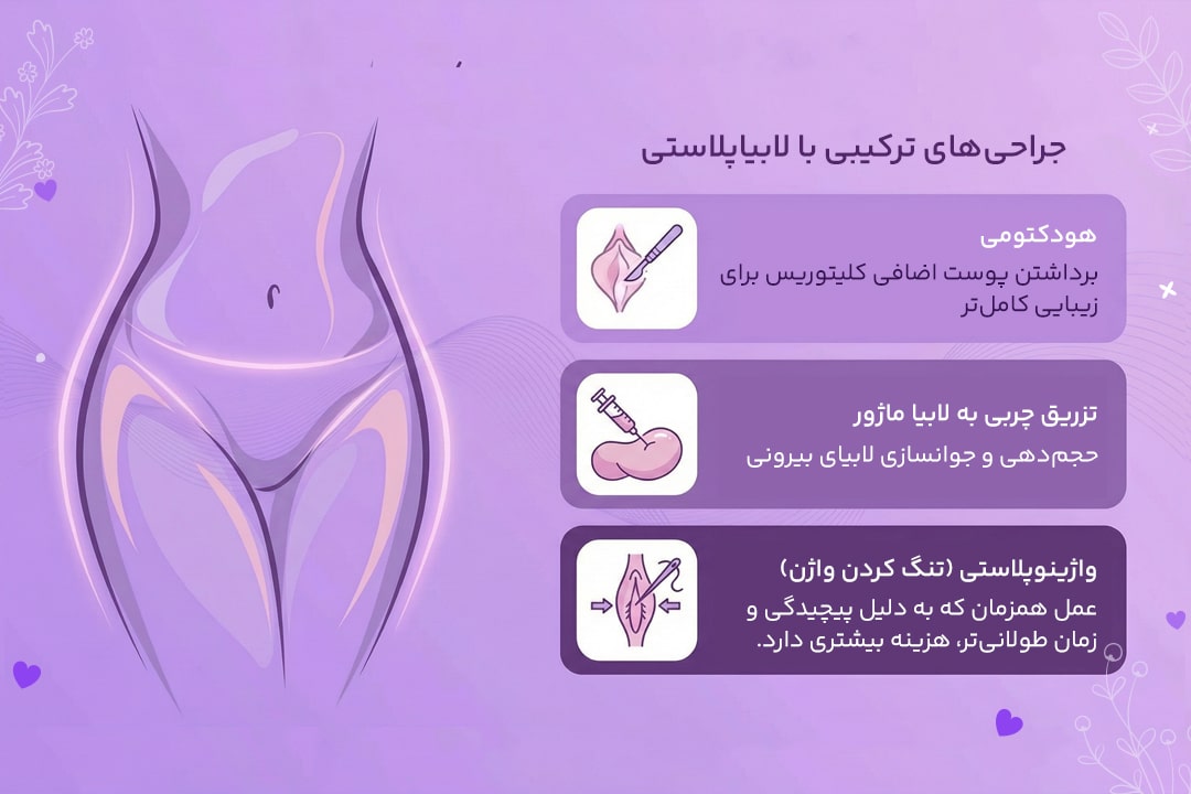 هزینه لابیاپلاستی در سال 1405 و عوامل موثر بر قیمت آن 4 جراحی های ترکیبی با لابیاپلاستی