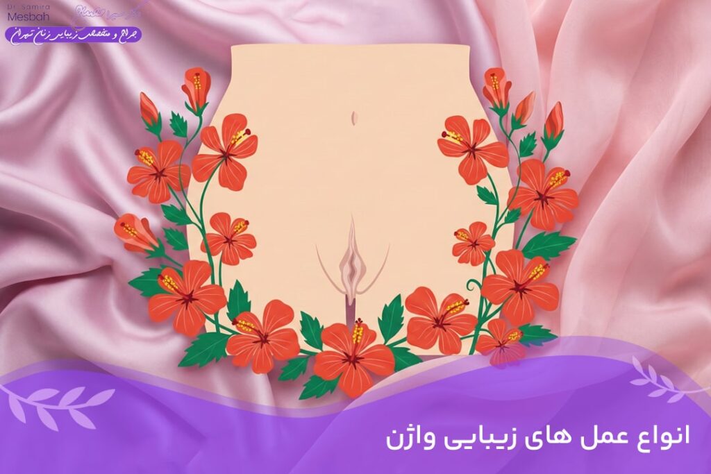 معرفی انواع عمل زیبایی واژن 8 معرفی انواع جراحی های زیبایی زنان