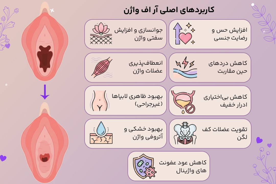کاربردهای اصلی و مزایای شگفت‌انگیز آر اف واژن