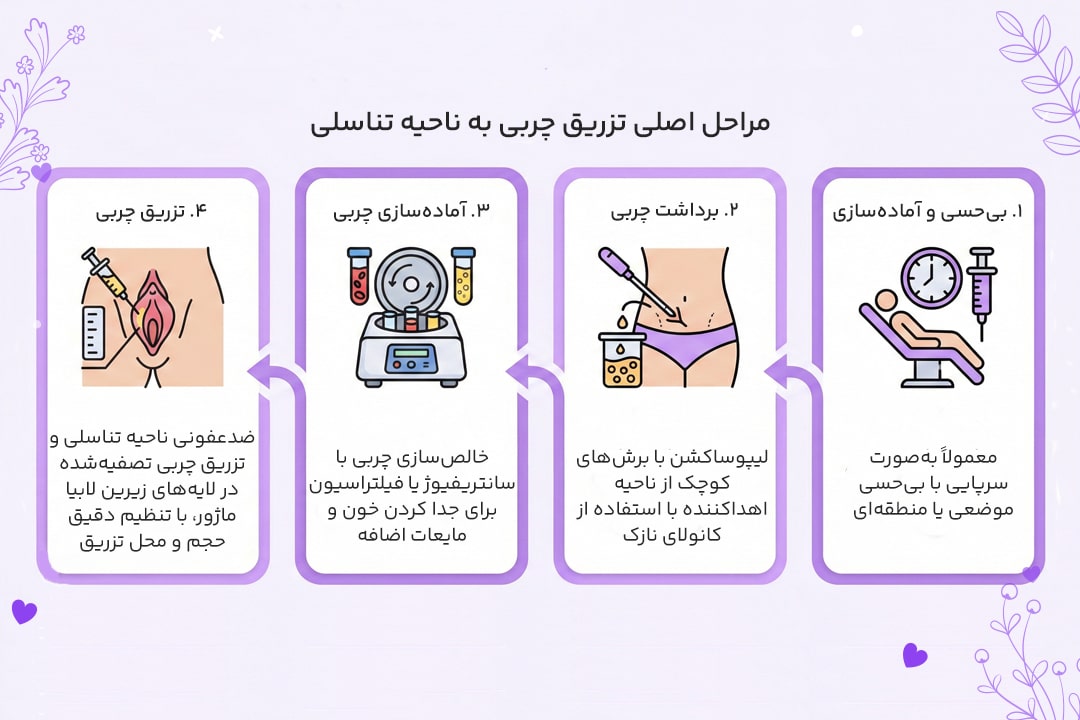 تزریق چربی به واژن 3 مراحل تزریق چربی به واژن: از برداشت تا تزریق
