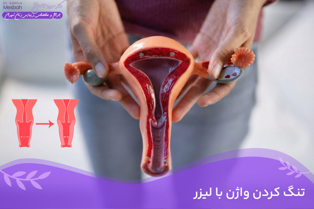 تنگی واژن با لیزر در تهران 1 تنگی واژن با لیزر