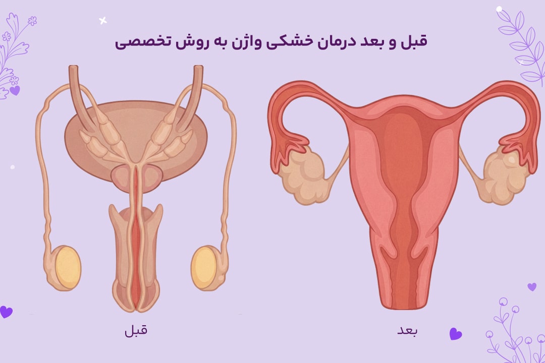 درمان خشکی واژن 1 عکس قبل و بعد درمان خشکی واژن